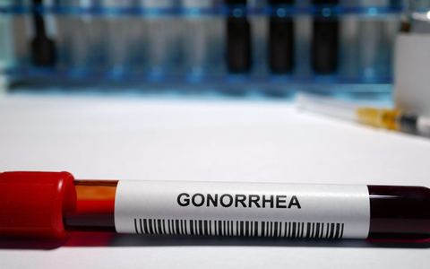 An image showing symptoms of gonorrhea: sore throat, fever, and vaginal discharge.